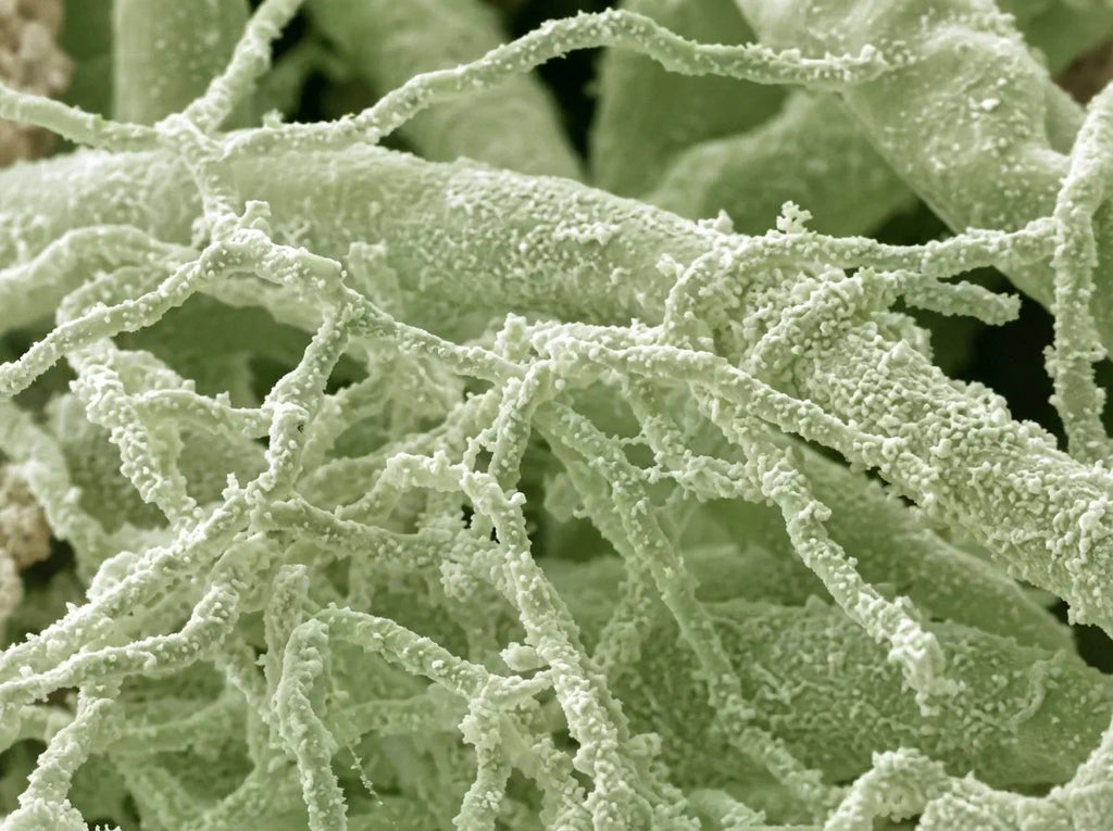 electron microscope photograph of Streptomyces sp.