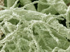 electron microscope photograph of Streptomyces sp.