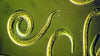 Magnified nematode